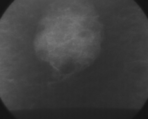 Röntgenaufnahme Bohrkern